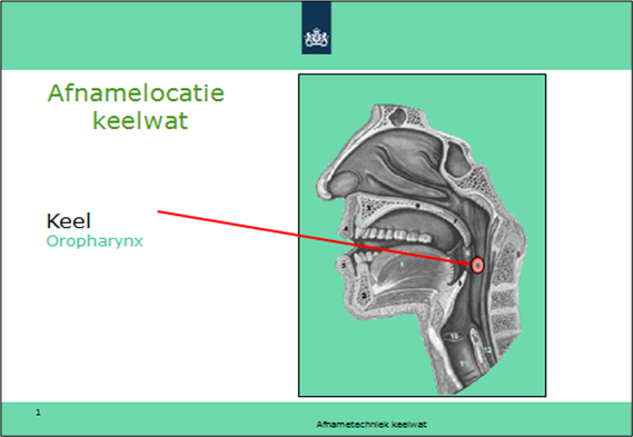 Afnamelocatie monsterafname keelwat MERS-CoV