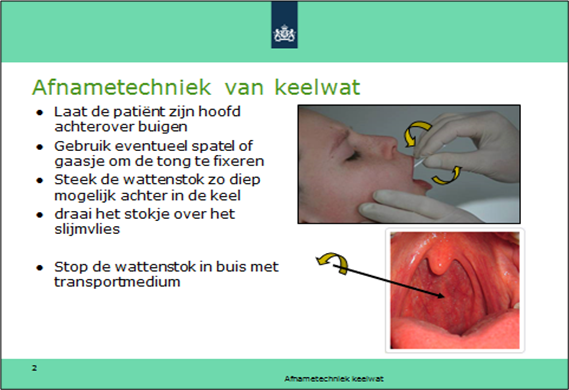 Afnametechniek monsterafname keelwat MERS-CoV